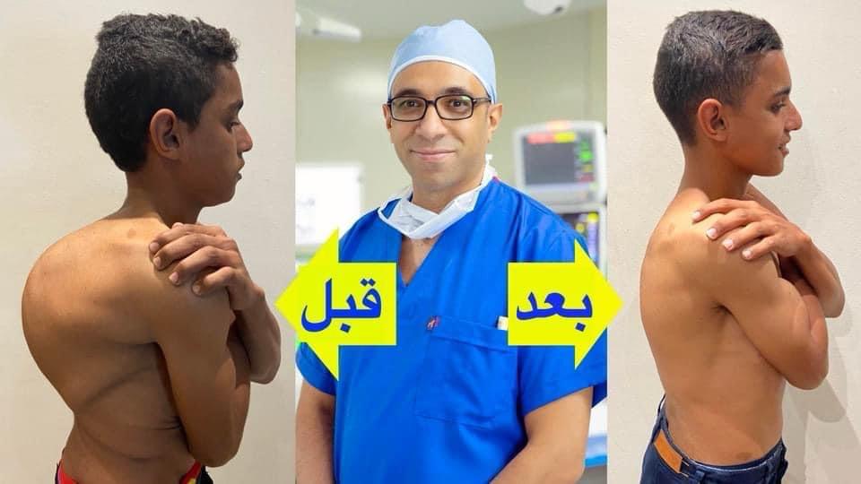 Kyphoscoliosis Correction surgeries