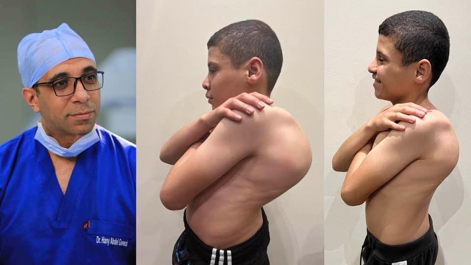 Kyphoscoliosis Correction surgeries