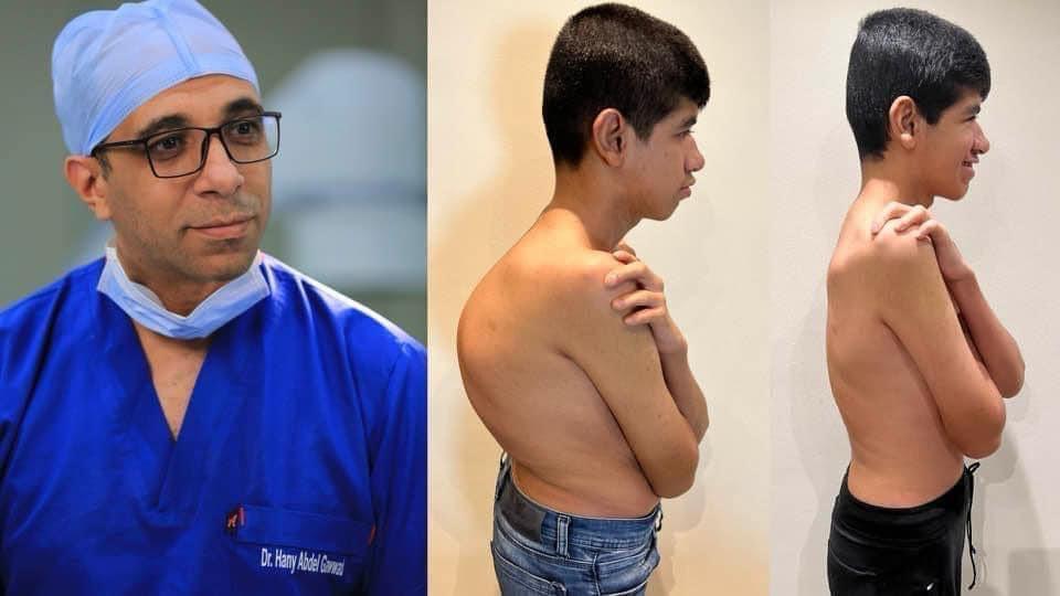 Kyphoscoliosis Correction surgeries