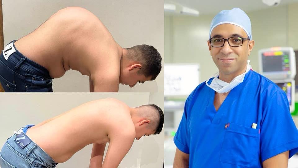 Kyphosis Correction Surgeries