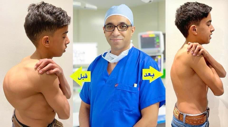 Kyphoscoliosis Correction surgeries